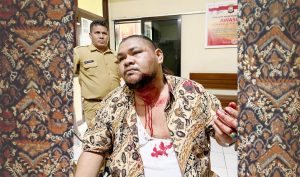Gunakan Pisau, Oknum Kontraktor Serang Wartawan Hingga Mandi Darah