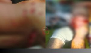 Istri Sempat Saksikan, Pria di Mangoli Timur Diterkam Buaya